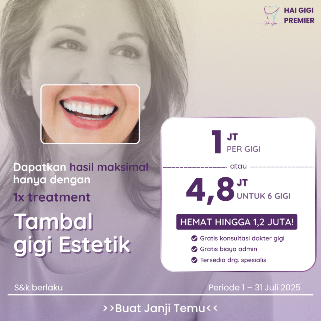 Promo paket-veneer-gigi-hai-gigi-premier