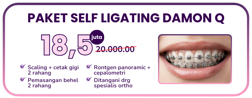 promo-hai-gigi-premier-paket-self-ligating-damon-q