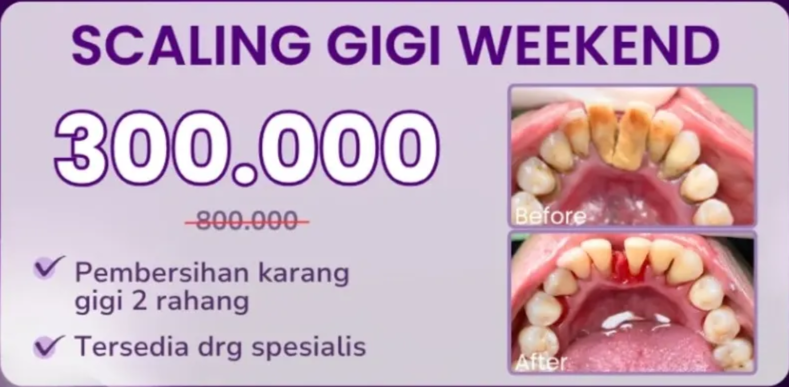 Scaling Gigi promo-scaling-gigi-weekend