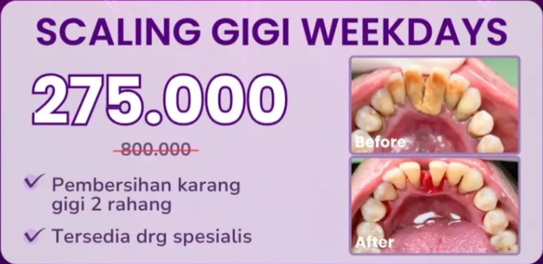 Scaling Gigi promo-scaling-weekdays-hai-gigi-premier