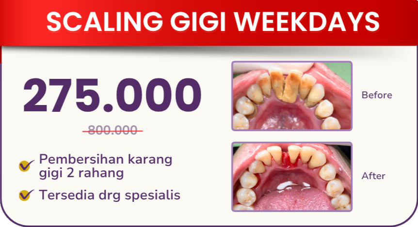 scaling-gigi-weekdays-hai-gigi-premier