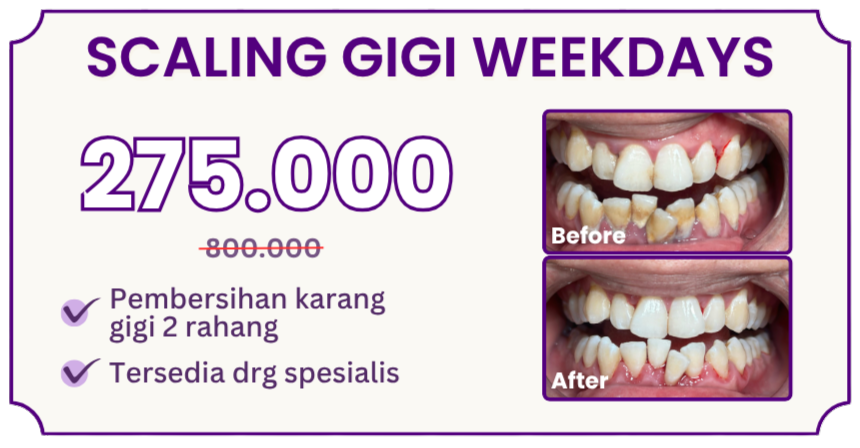 scaling-gigi-weekdays-hai-gigi-premier
