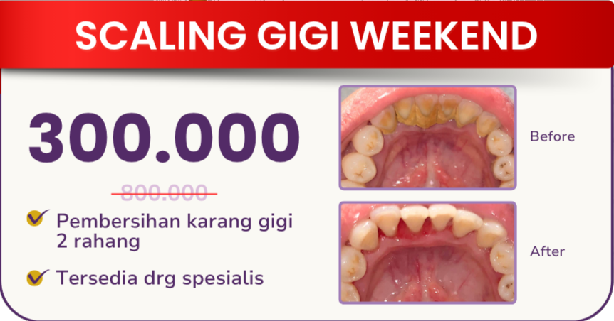 scaling-gigi-weekend-hai-gigi-premier