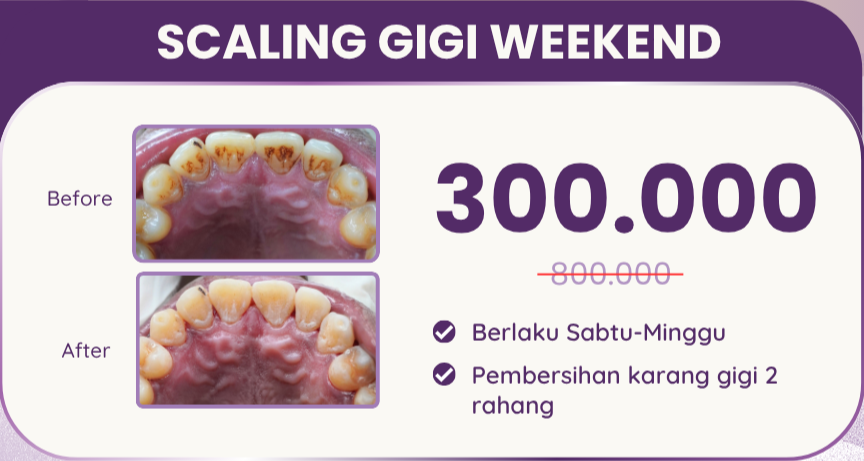 scaling-gigi-weekend