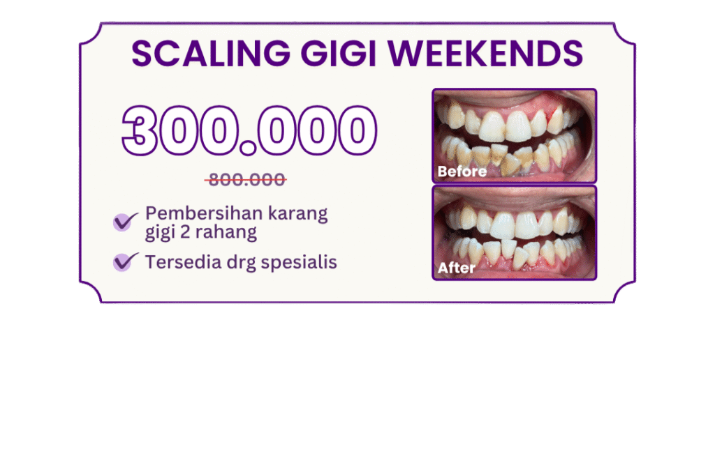 scaling-gigi-weekends-hai-gigi-premier