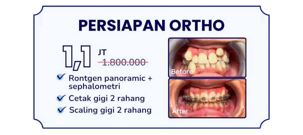 persiapan-ortho-hai-gigi-banyumanik