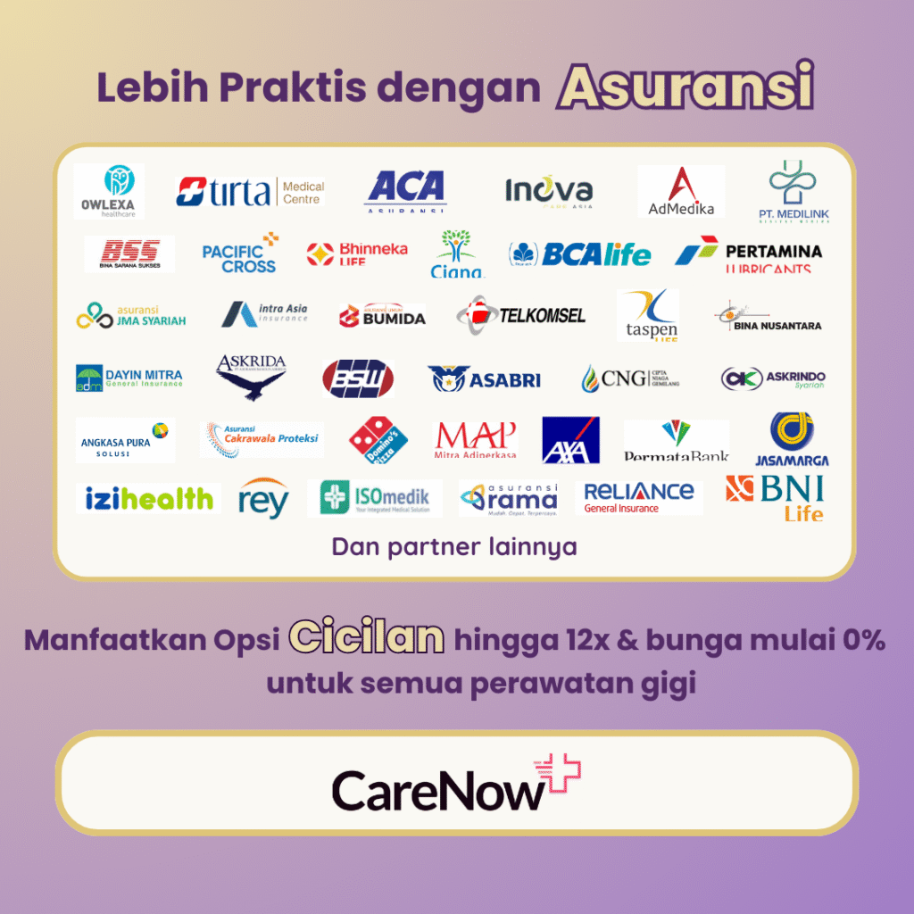 Promo Implan Gigi Promo Implan Gigi