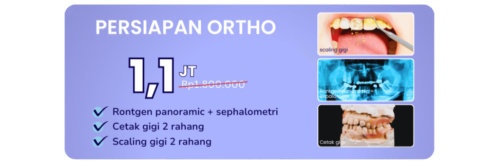 promo-persiapan-ortho-hai-gigi-banyumanik