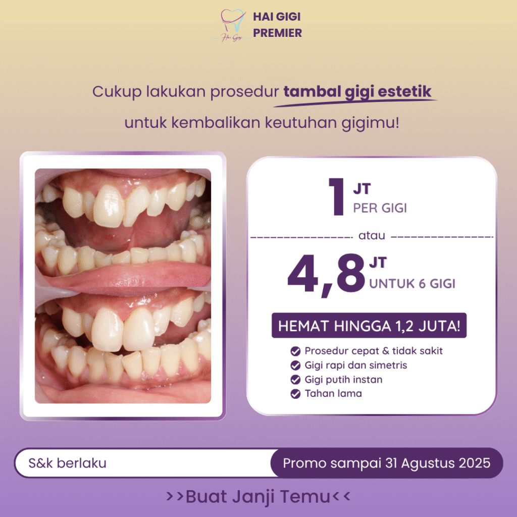 tambal-gigi-estetik-hai-gigi-premier