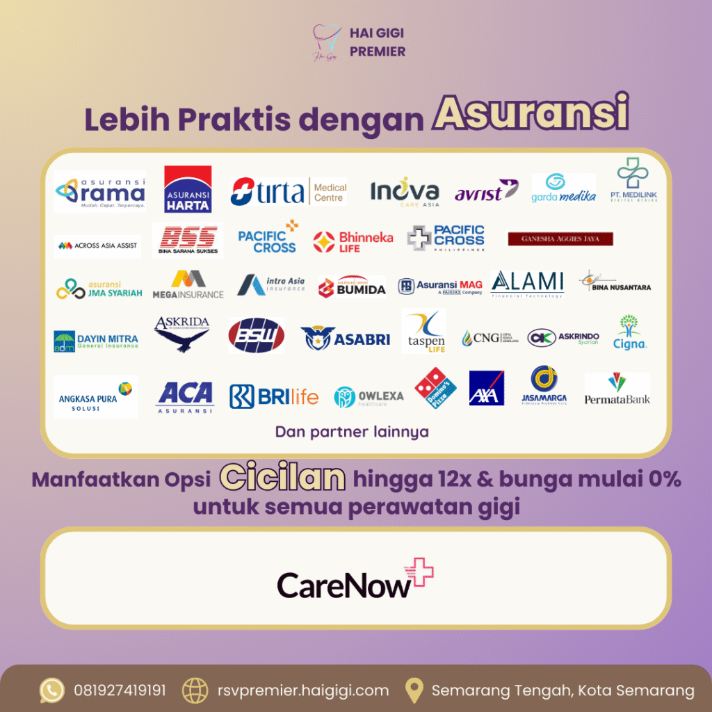 Promo Behel Mahasiswa