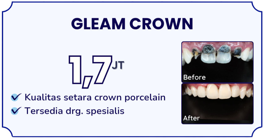 gleam-crown-hai-gigi-banyumanik