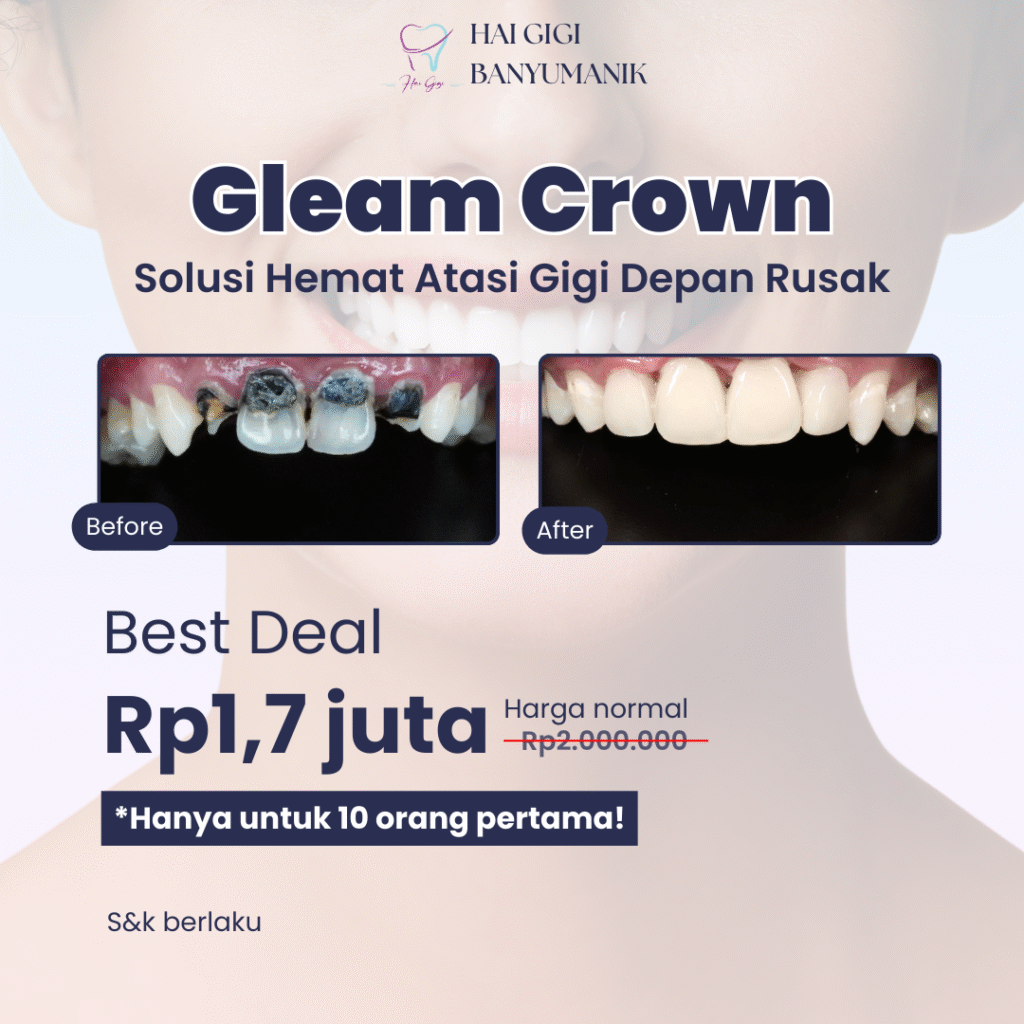 Promo Promo