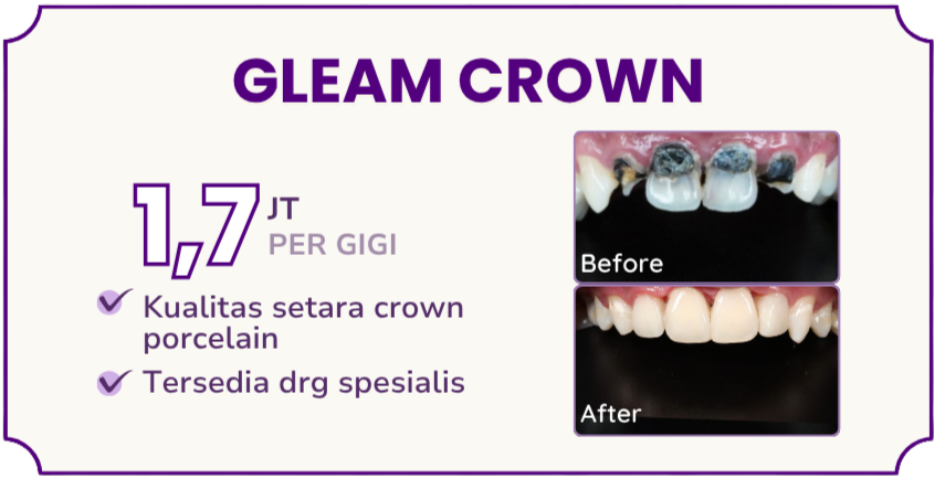 gleam-crown-hai-gigi-premier
