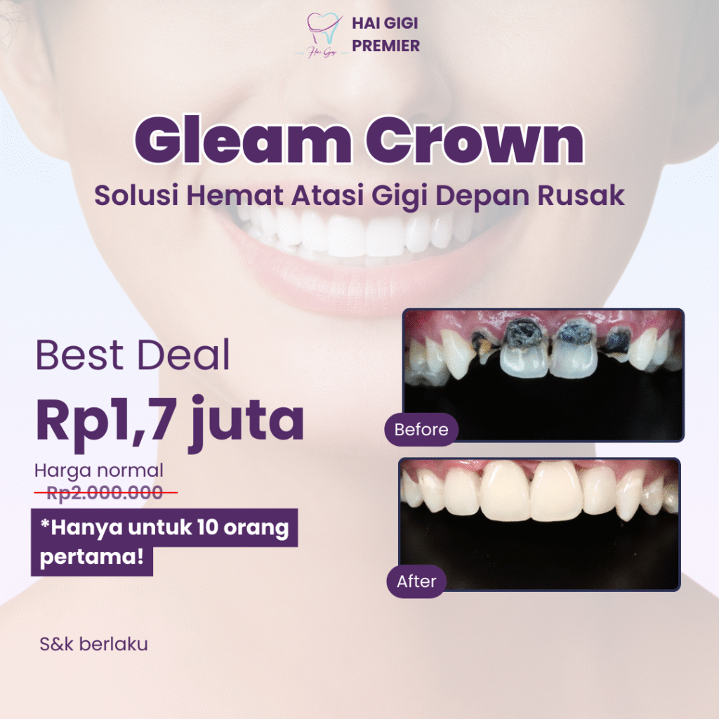 Promo gleam-crown-hai-gigi-premier
