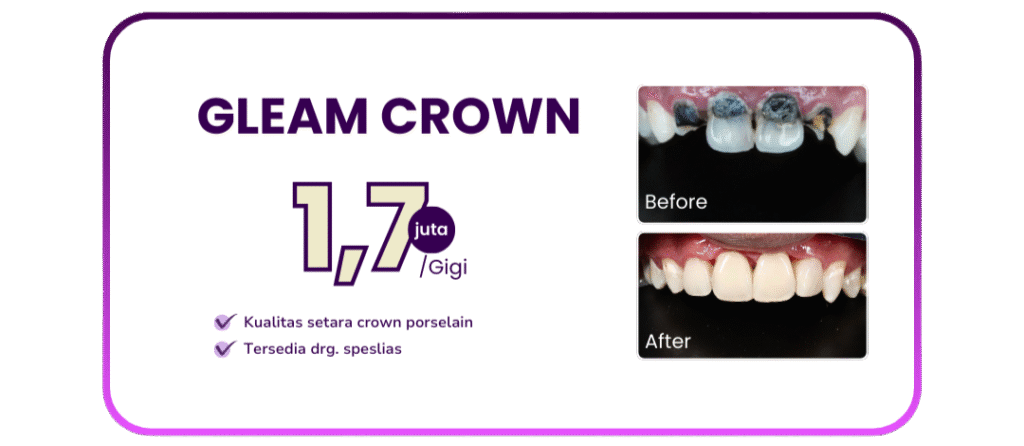 gleam-crown-hai-gigi-premier