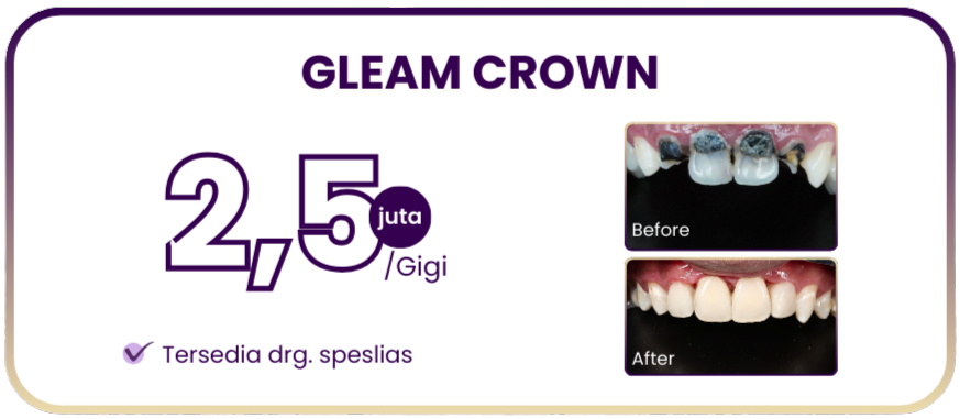 gleam-crown-hai-gigi-premier