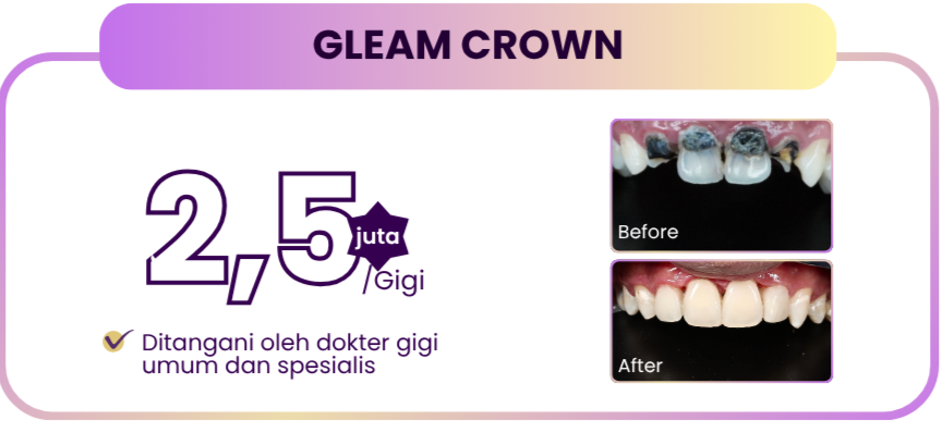 gleam-crown-hai-gigi-premier