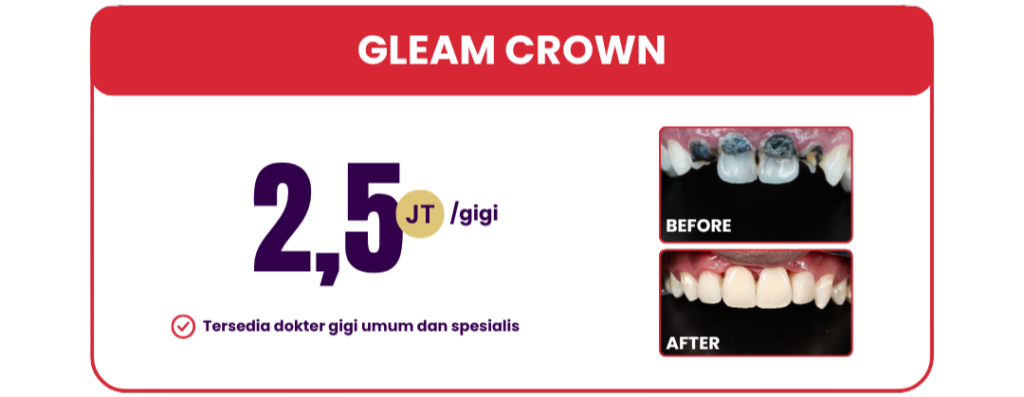gleam-crown-hai-gigi-premier