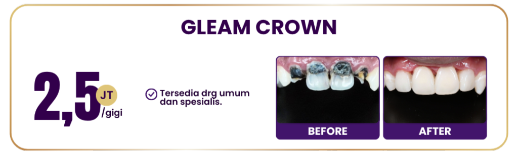 gleam-crown-hai-gigi-premier