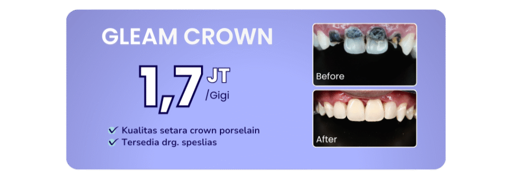 promo-gleam-crown-hai-gigi-banyumanik