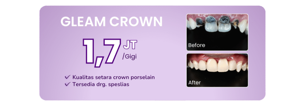 promo-gleam-crown-hai-gigi-premier