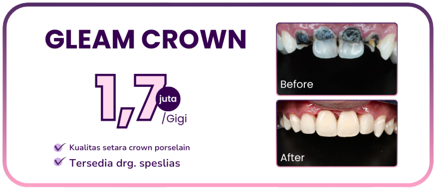 promo-hai-gigi-premier-gleam-crown