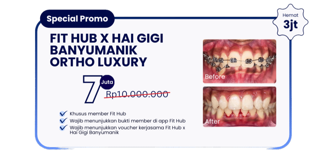 promo-fithub-behel-hai-gigi-banyumanik