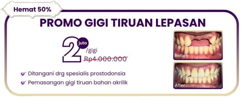 gigi-tiruan-lepasan-hai-gigi-premier-1