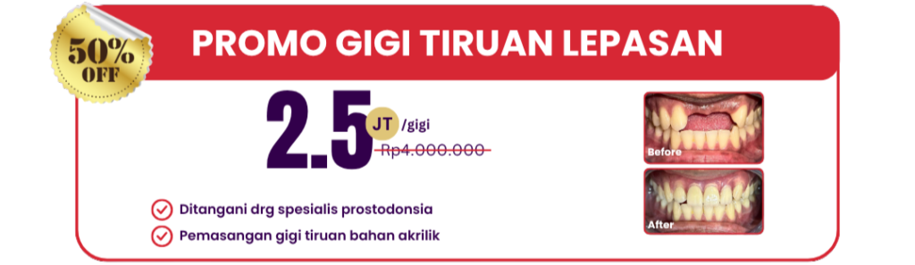 gigi-tiruan-lepasan-hai-gigi-premier