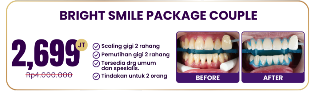 bright-smile-package-couple-hai-gigi-premier