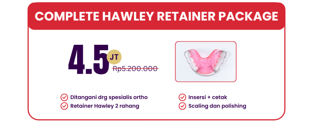 complete-hawley-retainer-hai-gigi-premier