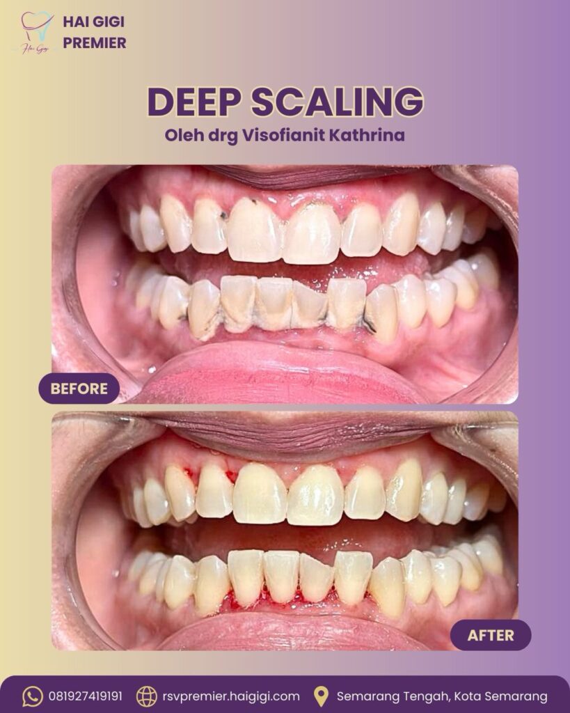 deep-scaling-hai-gigi-premier (2)
