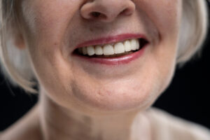 gigi-tiruan-hai-gigi-dental-clinic