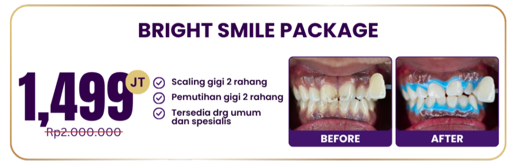 promo-bright-small-package-hai-gigi-premier
