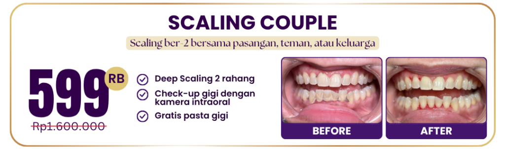 scaling-couple-hai-gigi-premier