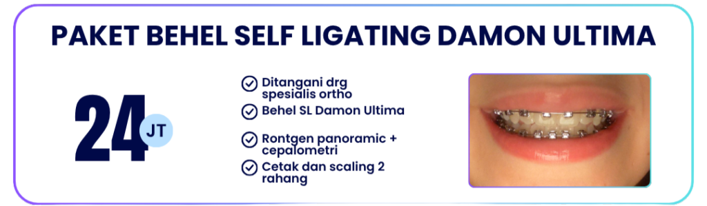 paket-behel-self-ligating-damon-ultra-hai-gigi-banyumanik