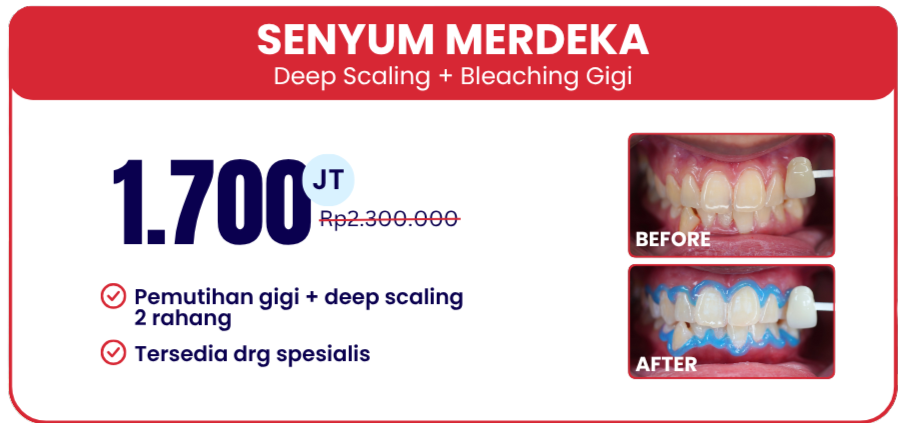 promo-senyum-merdeka-hai-gigi-banyumanik