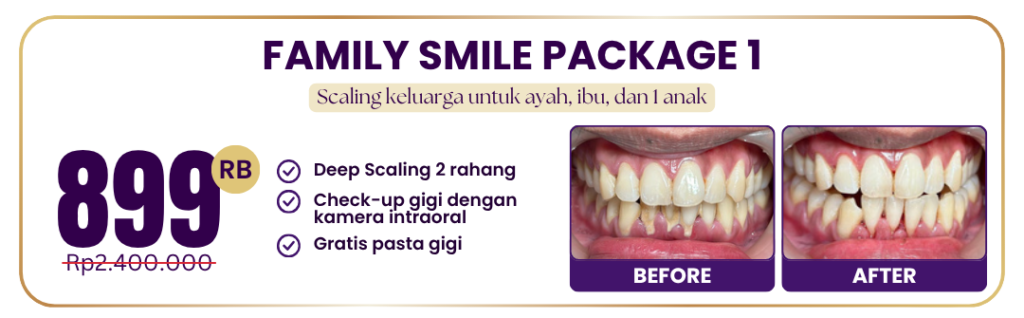 family-smile-package-1-hai-gigi-premier