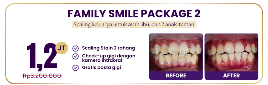 family-smile-package-2-hai-gigi-premier